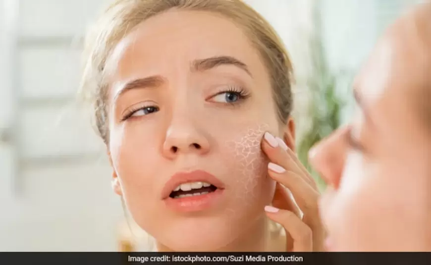 Foods For Dry Skin In Winter: ड्राई स्किन से पाना है छुटकारा,तो डाइट में जरूर शामिल करें ये सब्जियां