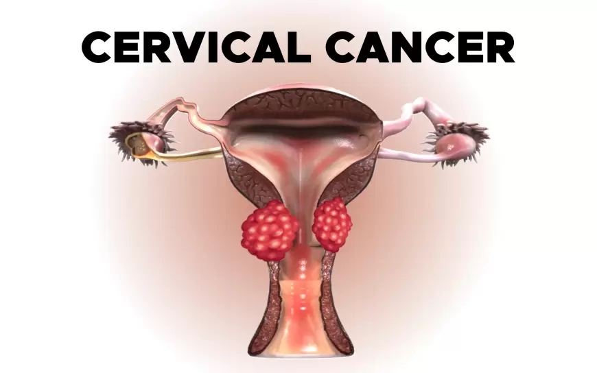 Cervical Cancer Vaccine: क्या है Cervical Cancer और कहां लगवा सकते है ये फ्री वैक्सीन?