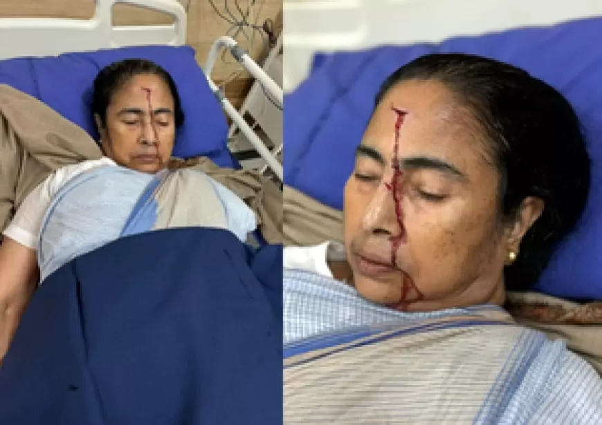 Mamta Banerjie Accident: बंगाल सीएम ममता बनर्जी को लगी चोट, पीछे से 'धक्के' के कारण गिर गईं ममता