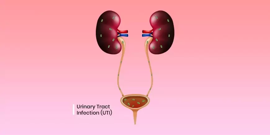 UTI Causes: UTI से होने वाली दिक्कतों से है परेशान तो करें ये उपाय