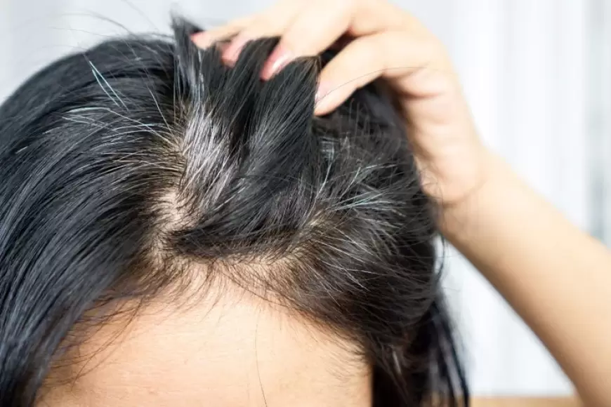 Home Remedies for Grey Hair:सफेद बालों से है परेशान तो इन आसान घरेलू उपायों से पायें चमचमाते काले बाल